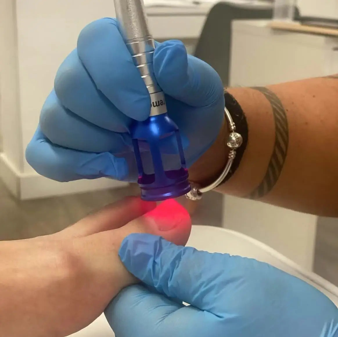 BEST 60W 6 in 1 Diode Laser 980nm Spider Vein Removal Machine Nail Fungus Removal Machine Remove Red Blood spider Veins