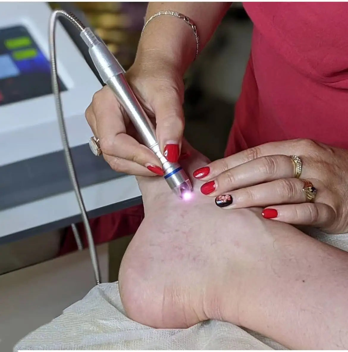 BEST 60W 6 in 1 Diode Laser 980nm Spider Vein Removal Machine Nail Fungus Removal Machine Remove Red Blood spider Veins